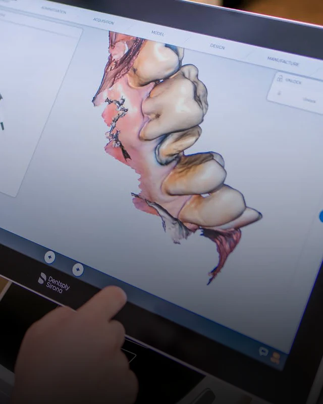 a detailed photo of a 3D computer image model of the inside of someone's mouth